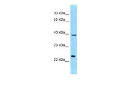 MUTED Rabbit anti-Human, Polyclonal, Novus Biologicals 0.1ml; Unconjugated:Antibodies,